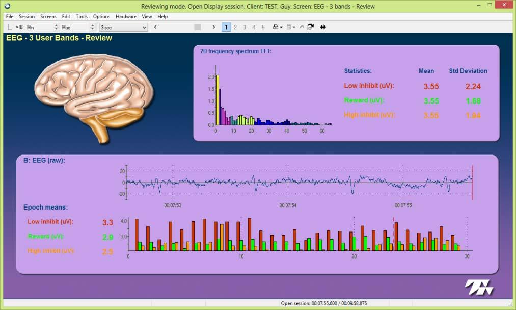 This training screen implements a simple three condition neurofeedback protocol, which encourages the amplitude of EEG activity in one Reward band while discouraging it in a Low and a High Inhibit