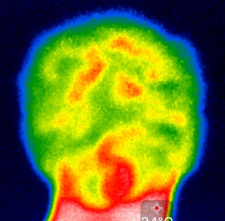 ThermoBuzzer is a cutting-edge mobile thermography technology combining a non-invasive, non-contact screening