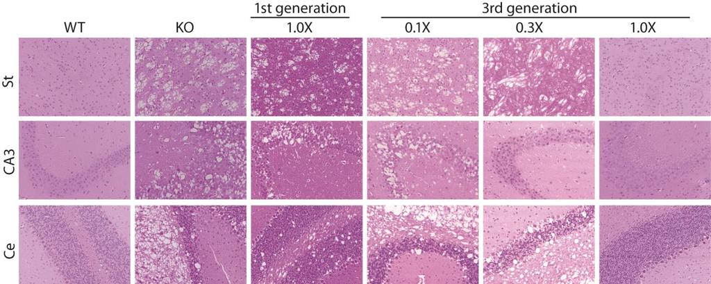 Fig. S9. Dose-dependent neuropathology. CD KO pups were treated intravenously at p1 with either 4x10 11, 1.33x10 11, or 4x10 10 GC of 3 rd generation gene therapy.