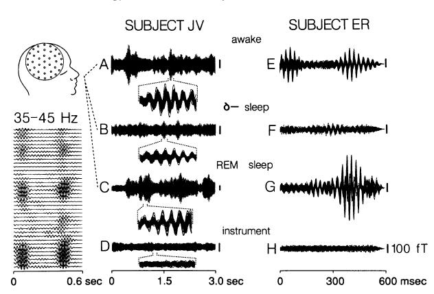 13 Comparison of wakefulness and dreams: 40-Hz oscillations characterise conscious states Spontaneous 40-Hz oscillations during wakefulness and REM sleep, but not slow-wave sleep Re-set of 40-Hz