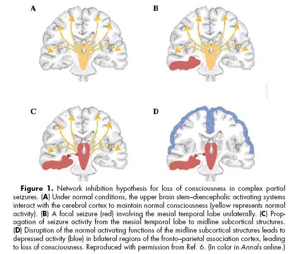 19 Loss of consciousness in epilepsy Yu &