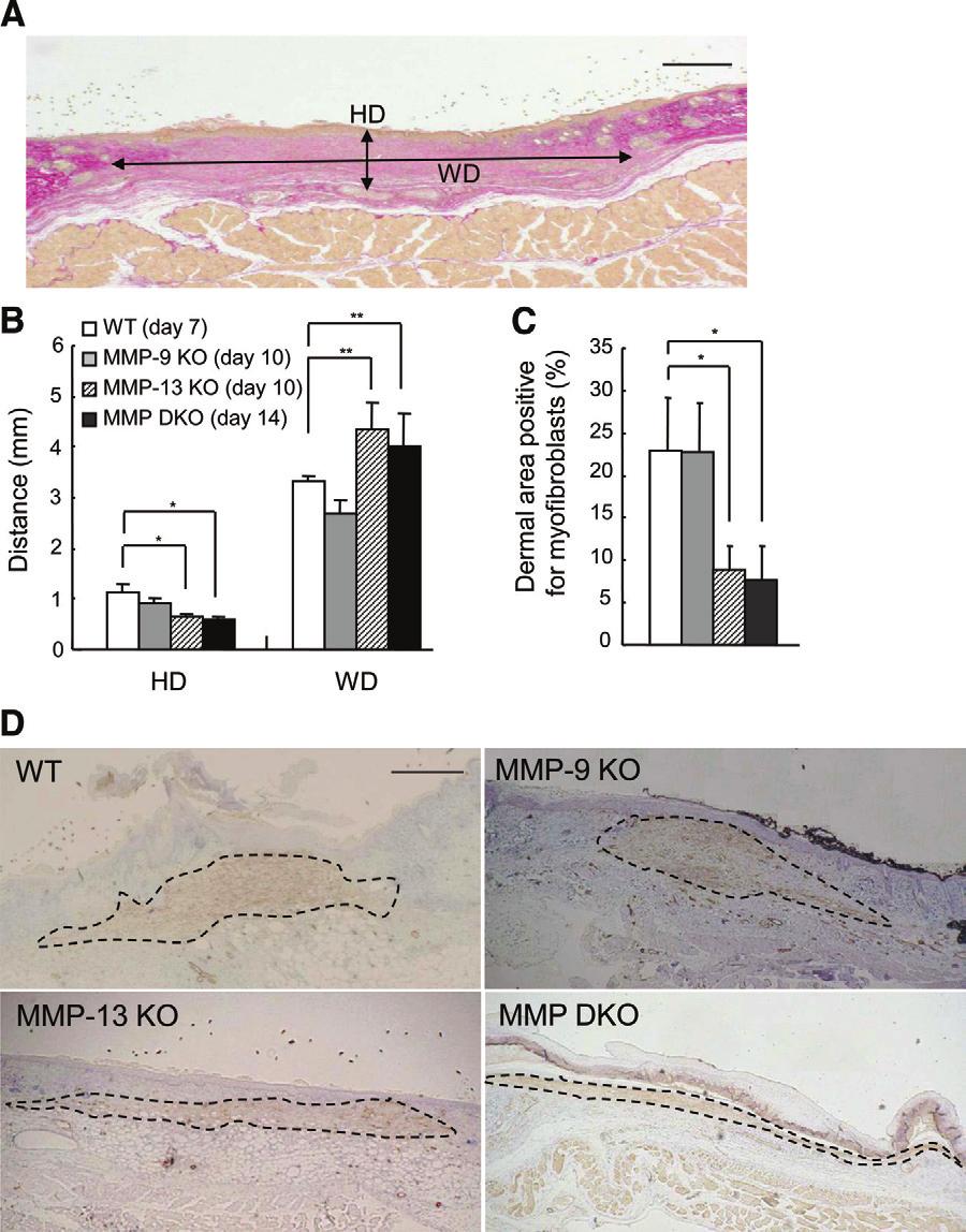 542 Hattori et al Figure 9. Analyses of granulation tissue and dermal area with myofibroblasts in wild-type (WT), MMP-9 KO, MMP-13 KO, and MMP-9/13 double KO mice.