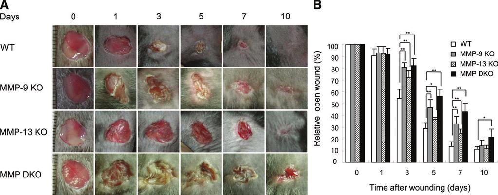 MMP-13 in Skin Wound Healing 537 Figure 1. Skin wound healing in wild-type (WT), MMP-9 KO, MMP-13 KO and MMP-9/13 double KO mice.