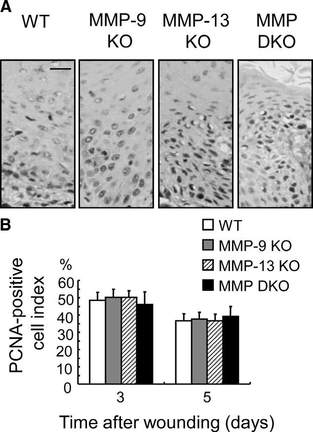 MMP-13 in Skin Wound Healing 539 MMP-1, 3, 7, and 13, especially MMP-13, re-activate VEGF activity through selective cleavage of CTGF in the complex.