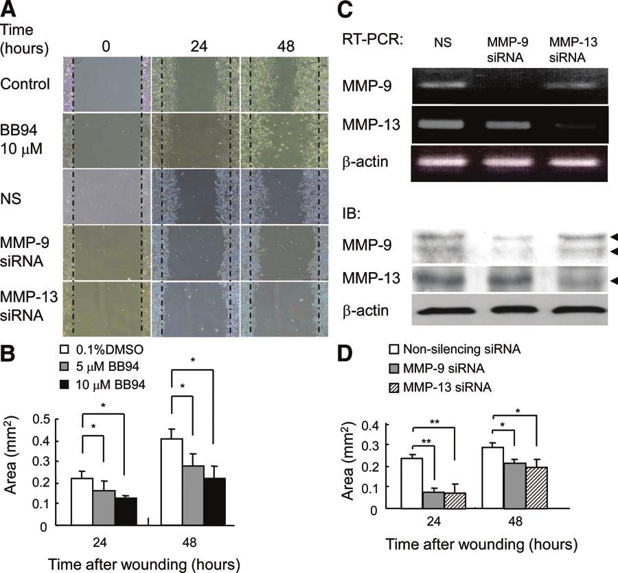 540 Hattori et al Figure 6. Involvement of MMP-9 and MMP-13 in keratinocyte migration in vitro. A: Effects of BB94 and sirna for MMP-9 or MMP-13 on migration of PAM212 keratinocytes.