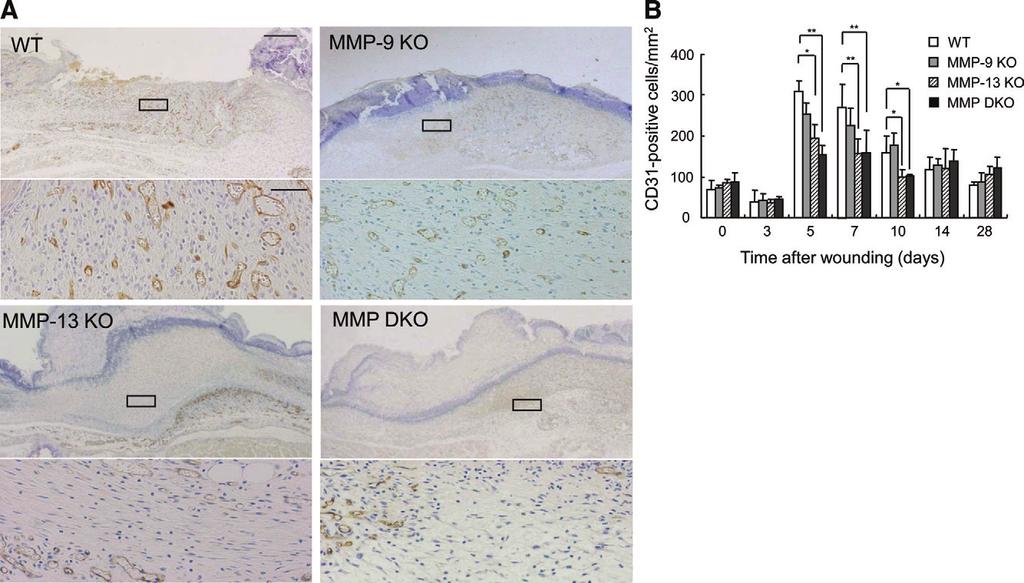 (Control) or 10 mol/l BB94 in 0.1% dimethyl sulfoxide. Similarly, keratinocytes were transfected with non-silencing (NS), MMP-9, or MMP-13 sirna and subjected to in vitro migration assay.