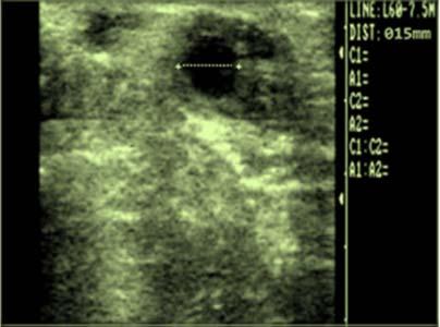 Embryo of 35 days pregnant (Ultrasonographic image) RESULTS AND DISCUSSION Successful economy of a dairy farm production lies in ensuing proper and optimal