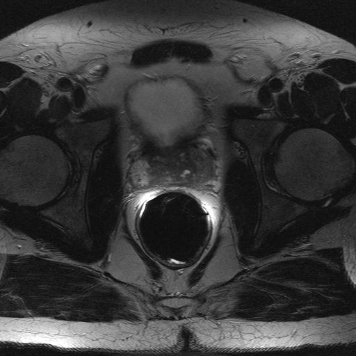 Patient Presentation Images T2-weighted axial