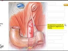 GI bleed Upper Esophageal Stomach Duodenum Hepatic Pancreatic