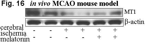 deficiency Cellular model of stroke MCAO mouse model