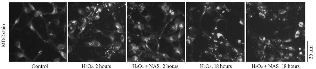 NAS inhibits H2O2-induced autophagic vacuoles/autophagosomes Journal of Neuroscience. 2014.