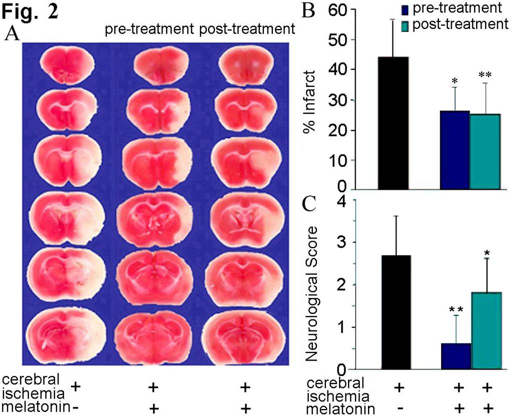 Melatonin decreases damage in Middle Cerebral Artery Occlusion (MCAO) mice Stroke. 2009.