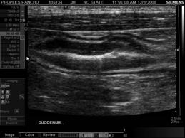 margin Multiple  Ultrasound Focal
