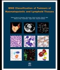 Principles and rationale of the WHO 2016 classification (updating the 4 th edition) the WHO classification emphasizes the identification of distinct clinicopathological entities, rather than just