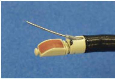 Endobronchial UltrasoundGuided Needle Aspiration (EBUS) Stations