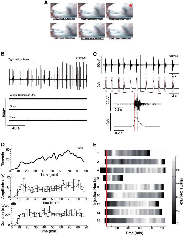 2130 Brain 2009: 132; 2125 2138 K. W. McCairn et al. Figure 2 EMG recording and the expression of tics. Video and EMG recordings following injection of bicuclline to the striatum.