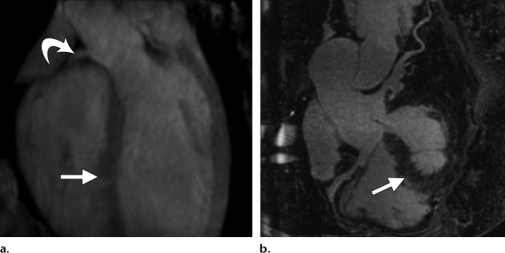 RG Volume 34 Number 6 Rajiah and Bolen 1631 Figure 18. Coronary artery imaging.