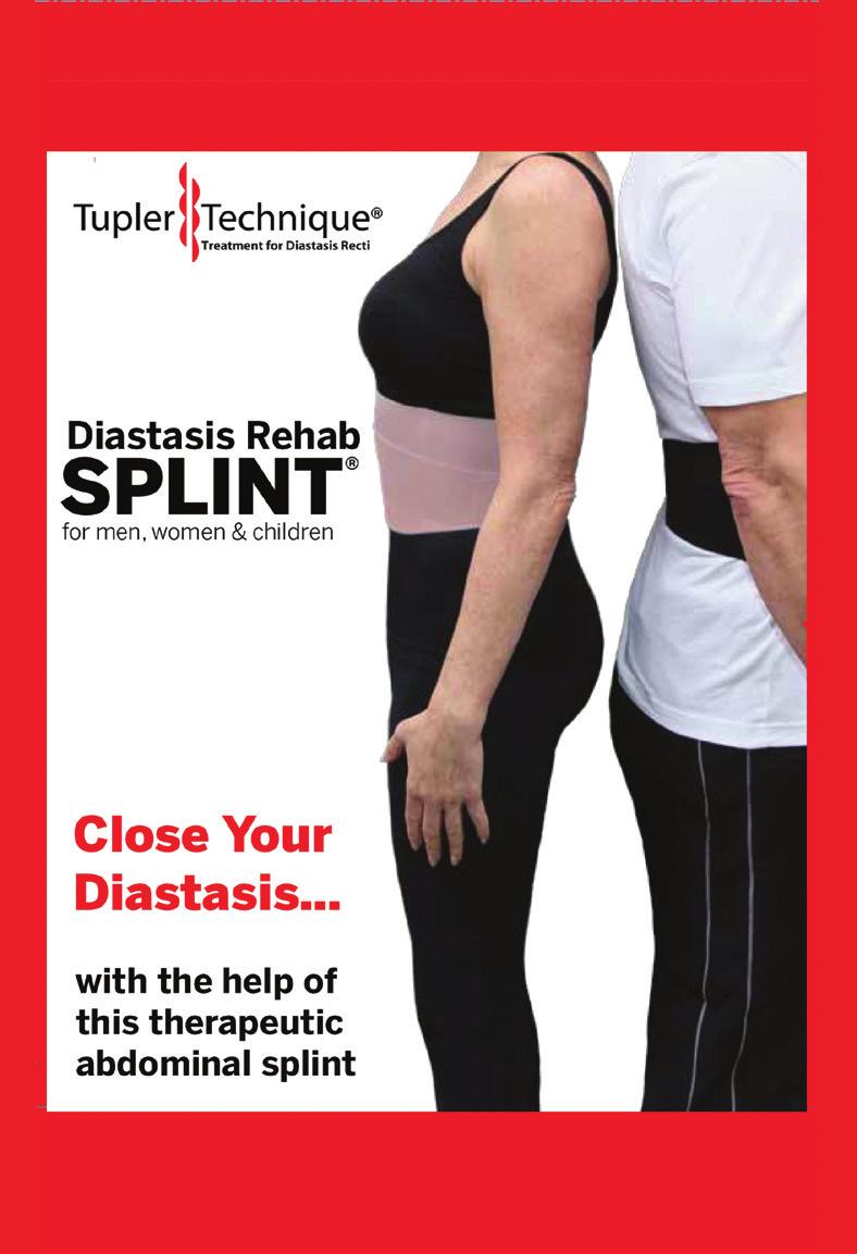 Splinting Tips The Diastasis Rehab Splint should be worn ALL the time. You can take it off to bathe. It can be worn against the skin or over a fitted undergarment.