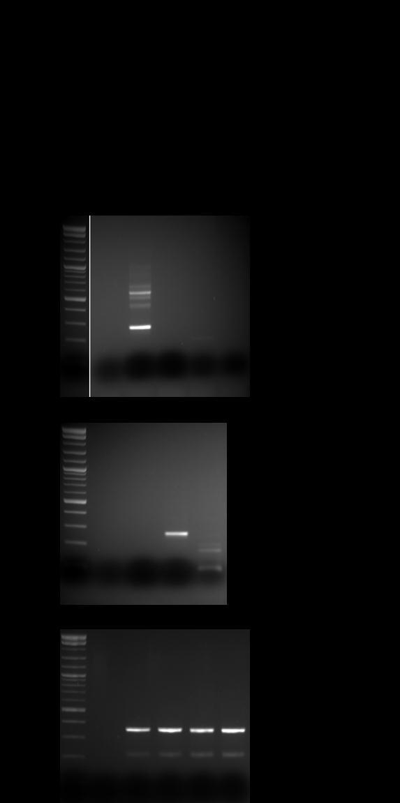 RT-PCR results for