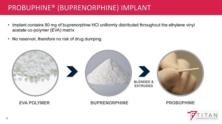 PROBUPHINE (BUPRENORPHINE) IMPLANT 6 Implant contains 80 mg of buprenorphine HCl uniformly distributed throughout the ethylene vinyl