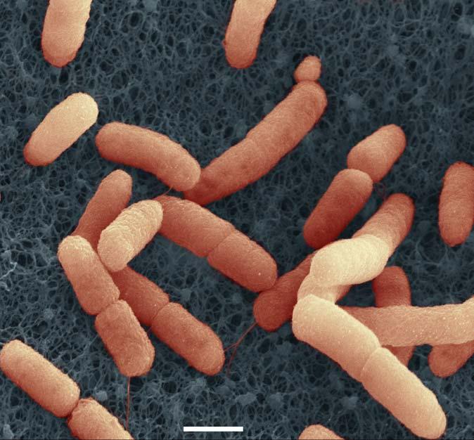 outbreak EHEC bacteria of the outbreak strain O104:H4 Scanning