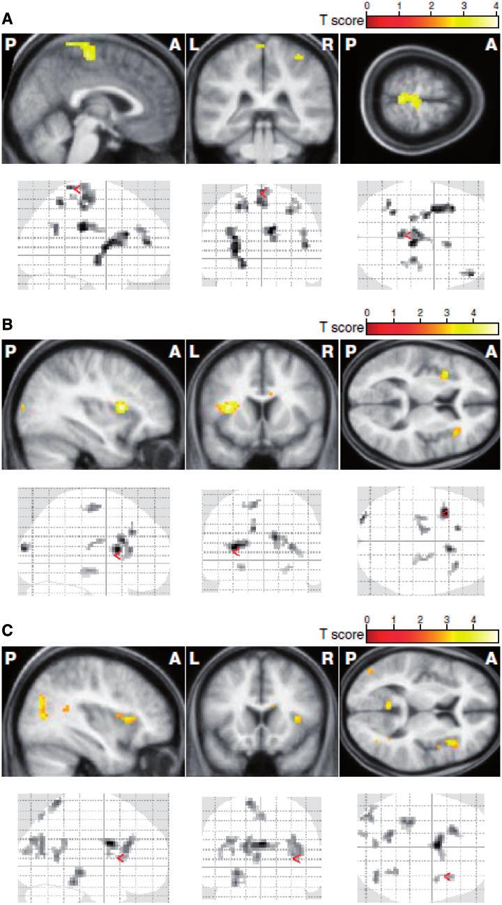 1172 Brain 2012: 135; 1165 1179 M. J. U. Novak et al.
