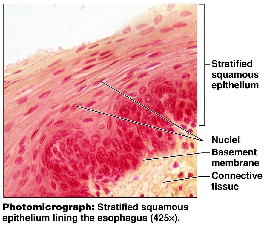 Description Epithelial Tissue Stratified Squamous Thick membrane composed of several cell layers; basal cells are cuboidal/columnar shaped; surface cells are flattened.