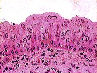 Description Epithelial Tissue Transitional Resembles both stratified squamous and stratified cuboidal.