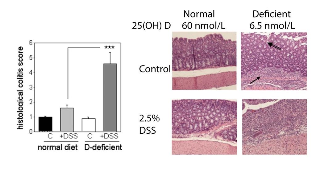 Severe Vitamin D Deficiency Enhances DSS-Induced Colitis Colitis examined 10 d after a 6 d course of