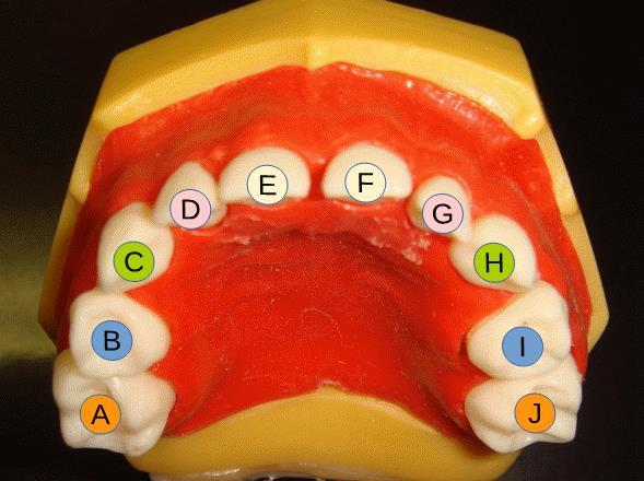 Tooth and Surface Identification (TID and SID) Dental treatment documentation and billing require to properly identify teeth and tooth surfaces.