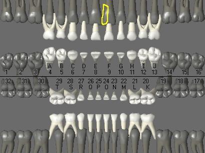 1.4. Supernumerary teeth Each identified permanent tooth and each identified primary tooth has its own identifiable supernumerary number.