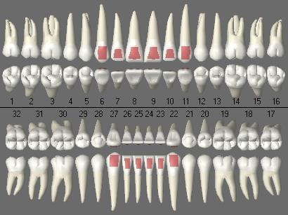 2.1. Distal Surfaces These are the sides of teeth that face away from the midline of the teeth. Every tooth has a distal surface. 2.2. Facial Surfaces These are the sides of the teeth that face toward the the face.