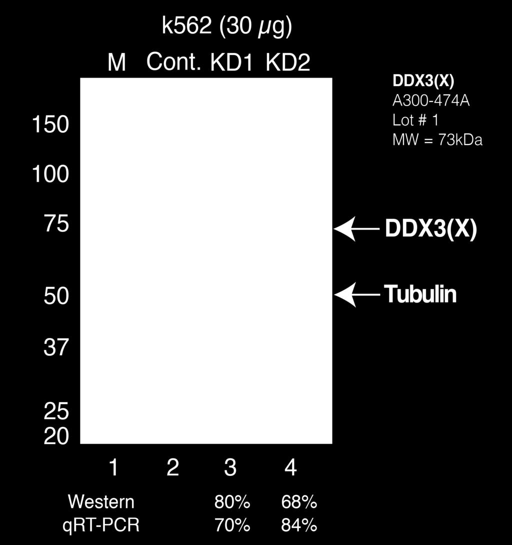Lane 3: 30 µg of protein from K562 transduced with an shrna targeting DDX3X (ENCODE Biosample ENCBS406BAI).