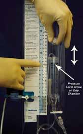 Set a System Pressure Threshold Raise or lower the drip chamber to the pressure setting described by the doctor The prescribed
