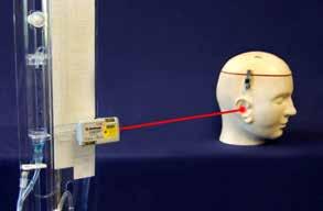 laser light points to the correct landmark on the patient s