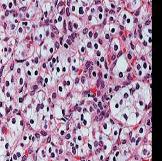 Histological Classification of