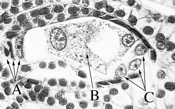The Immature Embryo Sac (Megagametophyte). Take the prepared slide labelled Lily Ovary - 4 nucleate Megagametophyte and observe it using your unaided eye.