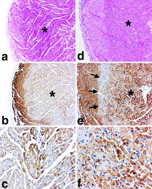 Sections of left ventricle from dog with 6h of coronary occlusion without reperfusion (a) Oedema and hypereosinophilia of myocytes in zone of necrosis (b) immunostaining for