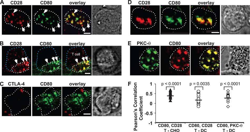 4858 DYNAMICS OF CD80 IN THE T CELL-DC SYNAPSE FIGURE 6. Dynamics of CD80 and TCR clusters in T cell-dc interface.