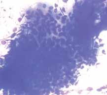 Cytological evaluation was performed. The cytological diagnosis from each case was based on cytomorphology and available clinical information.