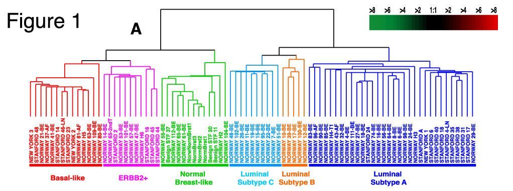 What is Luminal Breast Cancer? Intrinsic Subtypes by Gene Expression Profiling 