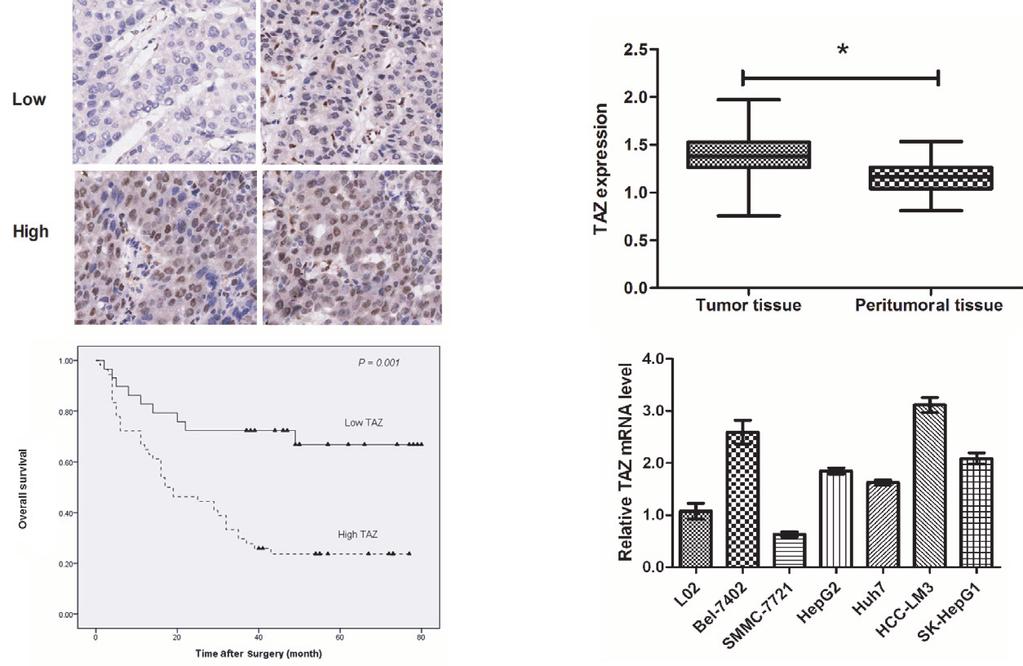 Original Article TAZ function in human hepatocellular carcinoma Shanghai, China) and were cultivated as described by the suppliers. Antibodies.