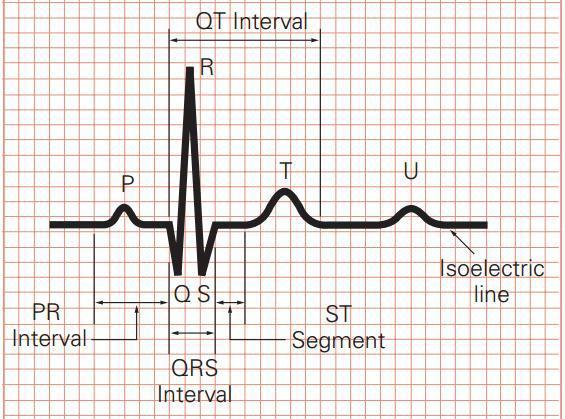 ECG Signal Characterization and Correlation To Heart Abnormalities Keerthi G Reddy 1, Dr.