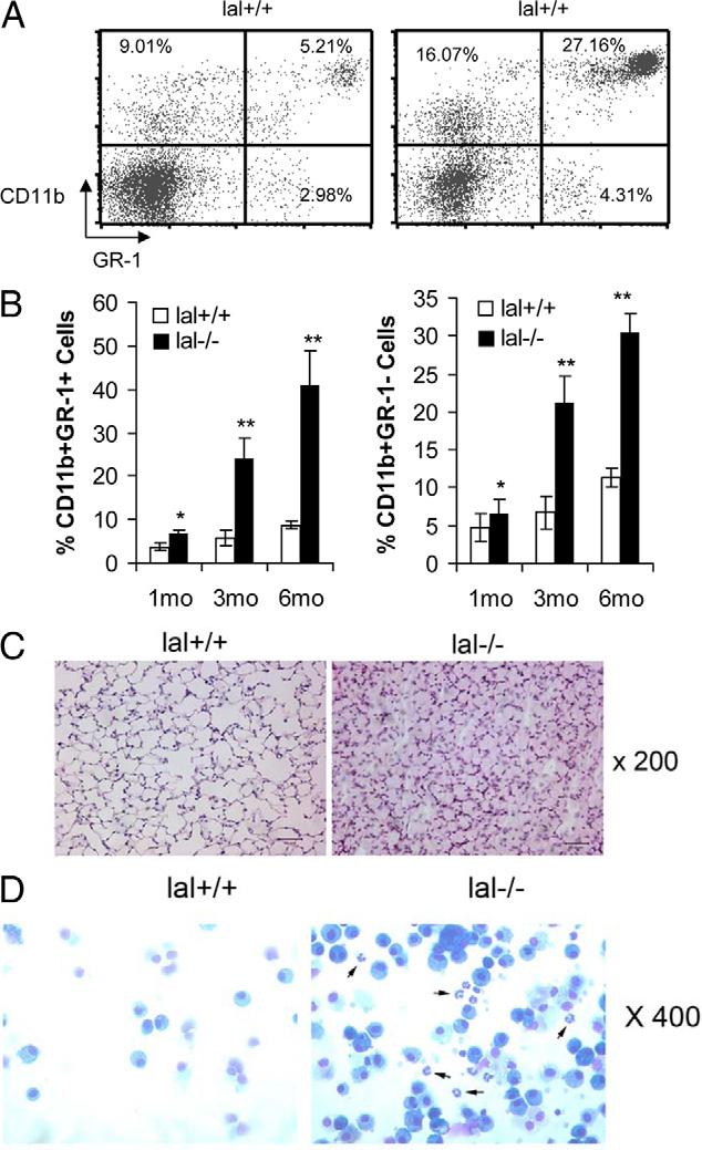 Lysosomal Acid Lipase in Myelopoiesis 2401 LAL Deficiency Results in Myeloid Cell Infiltration and Accumulation in the Lung In the lung of lal / mice, inflammatory cell infiltration caused emphysema
