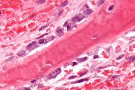 Osteoblasts From the Greek: bone + germinate Generated by stem cells Work in groups to synthesize collagen and proteins which make the bone matrix Photo credit: wikipedia (where else?