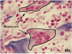 maintain Ca levels Osteoclasts Photo credit: MWSU Biology Department Endochronal vs.