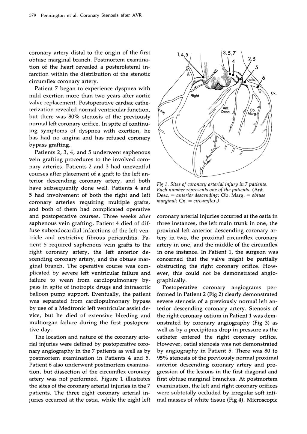 579 Pennington et al: Coronary Stenosis after AVR coronary artery distal to the origin of the first obtuse marginal branch.