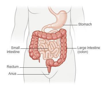 Introduction This leaflet is for people who have diverticular disease. It contains information about the disease and the best foods to eat if you have it. What is diverticular disease?