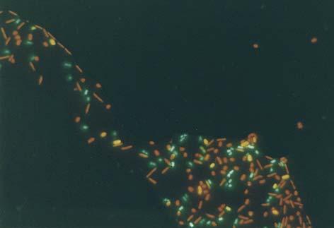 Dual Species Enteric Biofilm stained with propidium iodide E.