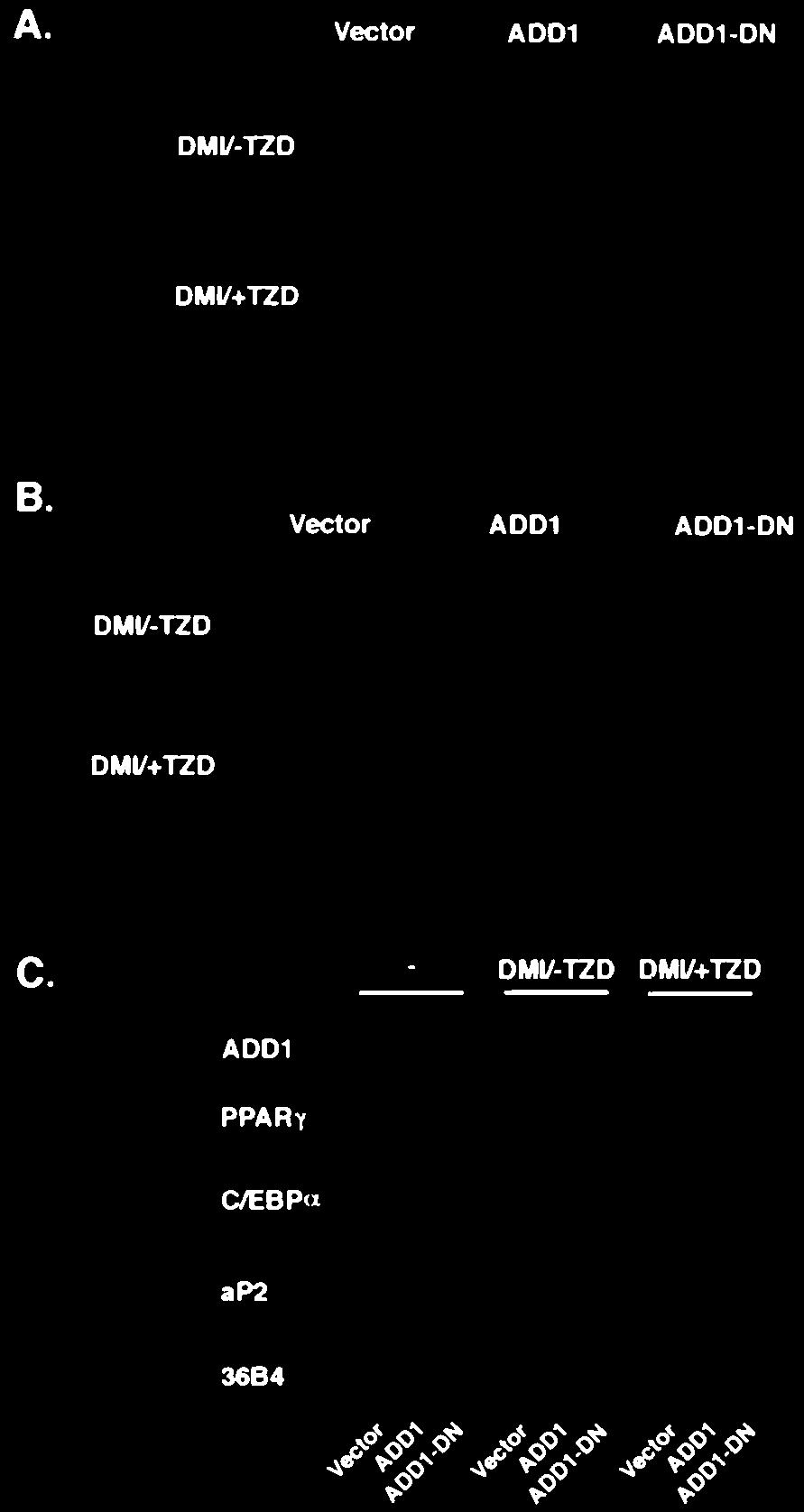 3T3-L1-vector, -ADD1, and -ADD1-DN cell lines were treated with differentiation inducers in the absence (DMI -TZD) or presence (DMI TZD) of the TZD ligand pioglitazone (5 M) for 48 hr at confluence